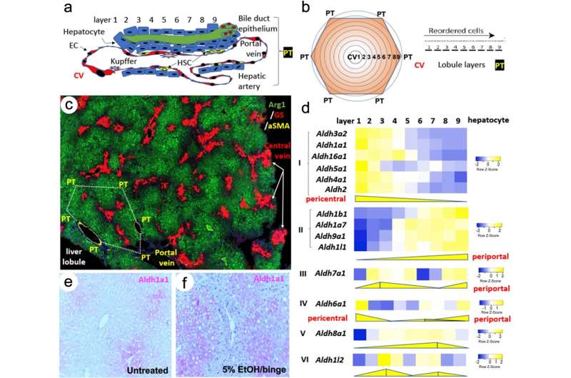 Acetaldehyde dehydrogenases in liver zonation and liver cancer