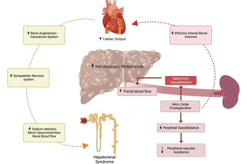 HRS-AKI treatment options could be expanded