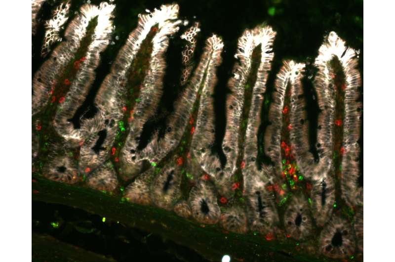 Unveiling a Novel Immune Response in the Intestinal Epithelium