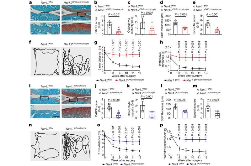 Epilepsy drug shows promise in slowing joint degeneration in osteoarthritis