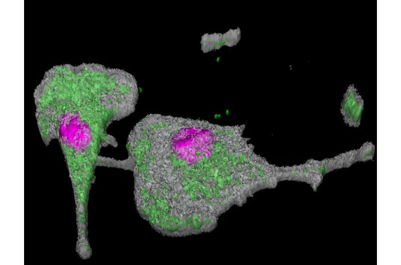 COVID-19: The persistence of SARS-CoV-2 in the lungs and the role of innate immunity