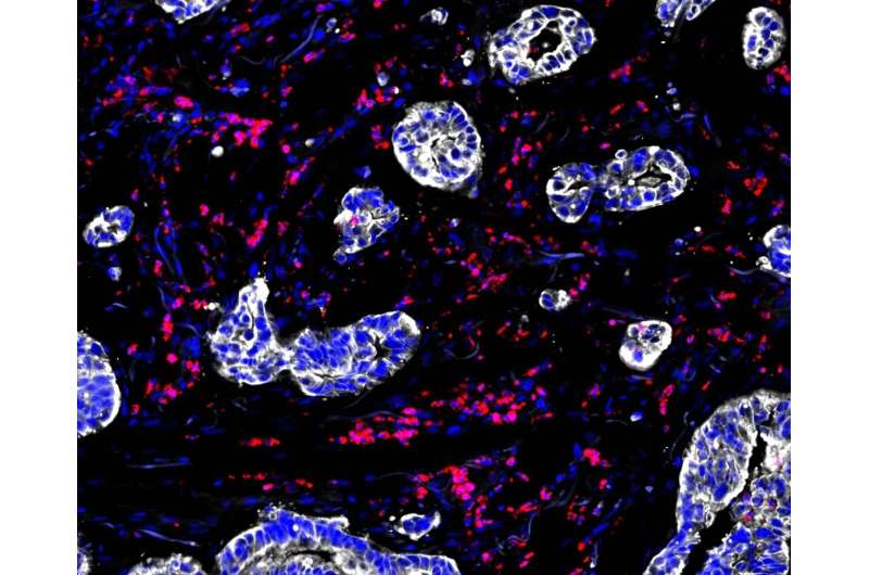 Cancer therapy bexmarilimab awakens immune cells to attack tumours that have avoided the detection of the immune system