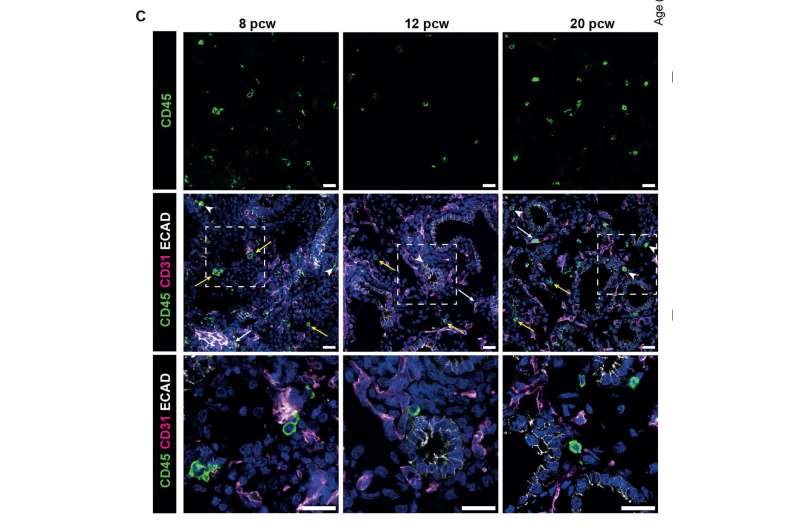 Research shows immune cells shape lung tissue before birth, provides new avenues for treating respiratory diseases