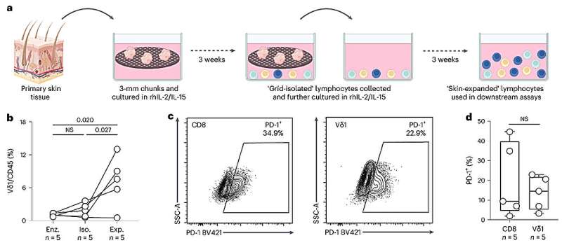 Immune cell helps predict skin cancer patients' chances of responding to treatment