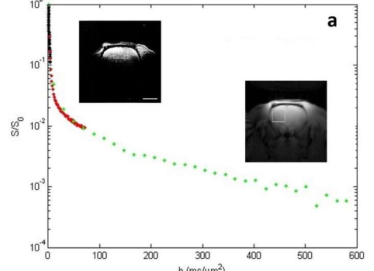 MRI innovation reveals cells' energy activity in organs and tissues