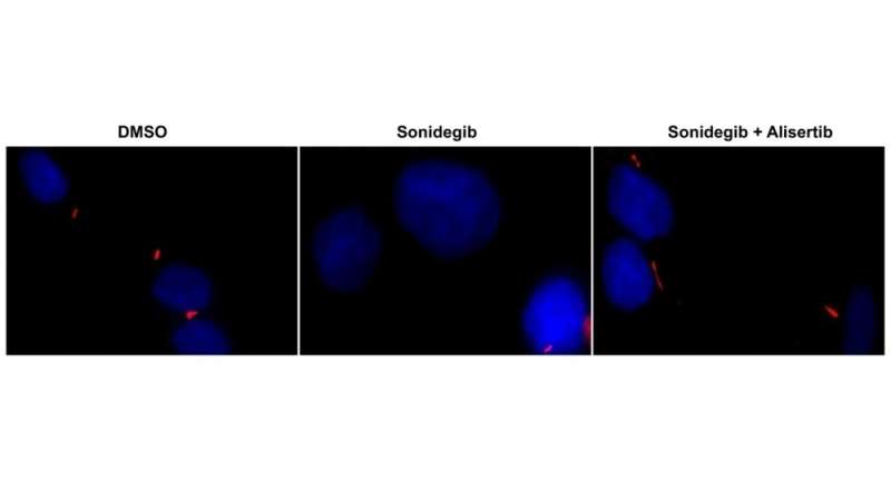 Study reveals mechanism involved in rare pediatric brain cancer and points to possible treatment