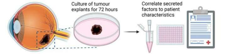 New tools to manage rare eye cancer