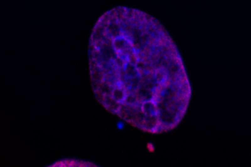 MSK-led research finds unexpected link between chromosomal instability and epigenetic alterations