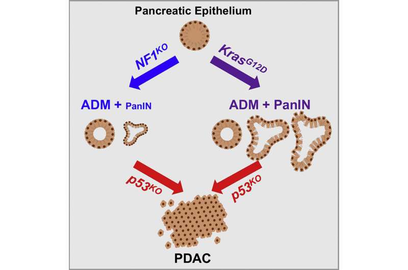 New genetic culprit suspected in the onset of pancreatic cancer