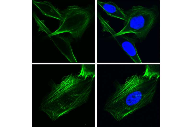 Study finds new, unexpected mechanism of cancer cell spread