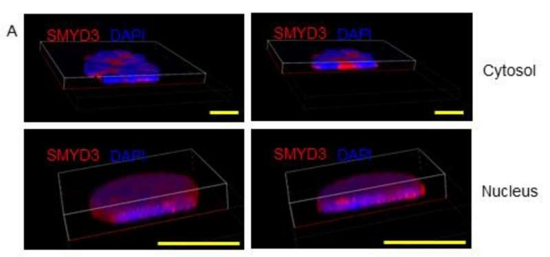 Researchers identify potential biomarker to distinguish two aggressive types of brain tumors in children