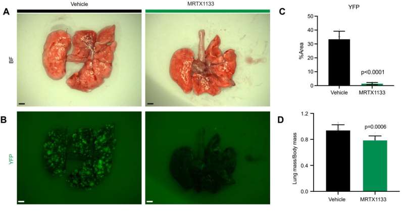 Study shows promise of new anti-KRAS drug for pancreatic cancer