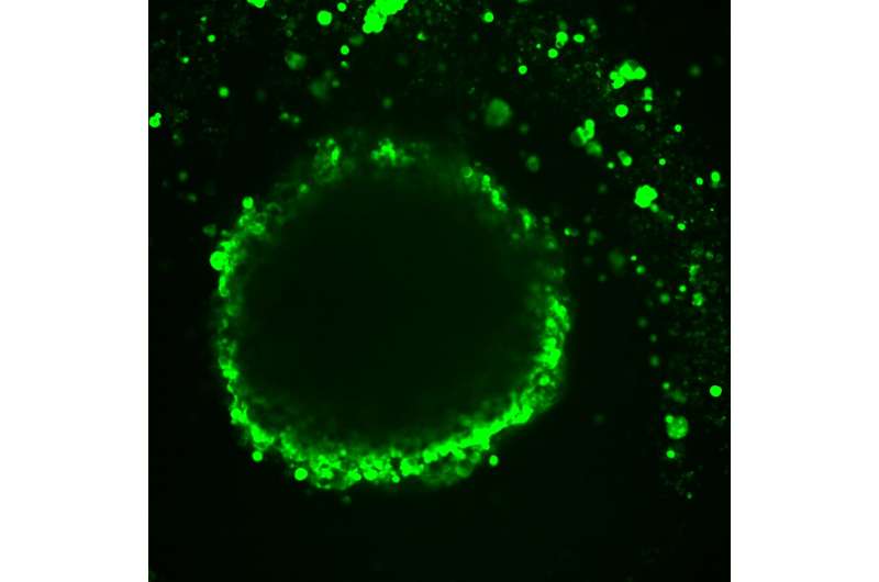 Researchers show how a tumor cell's location and environment affect its identity