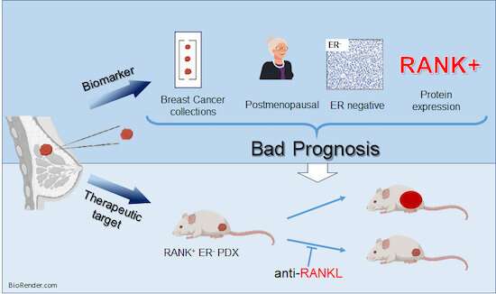 Researchers propose biomarkers to select breast cancer patients who could benefit from denosumab treatment