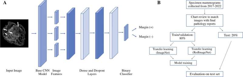 Researchers develop AI model to improve tumor removal accuracy during breast cancer surgery