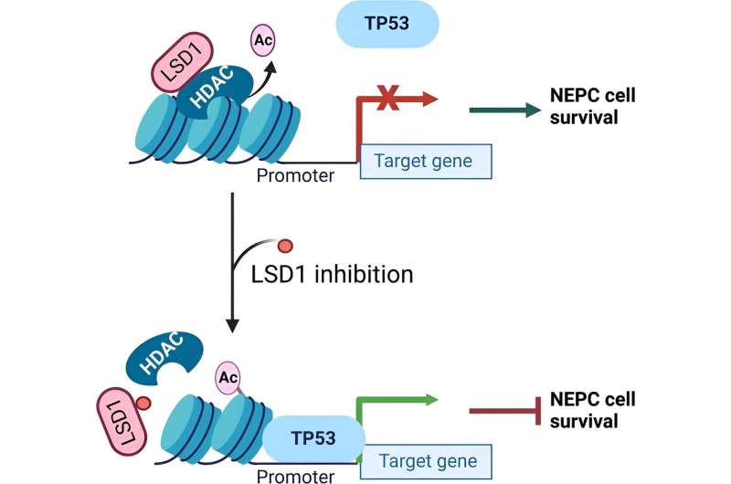 Study shows a new approach to target a deadly form of prostate cancer