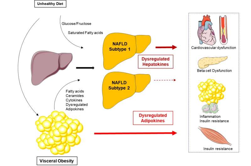 Non-alcoholic fatty liver disease: Hepatokines mediate its impact on metabolic diseases and help to identify subtypes