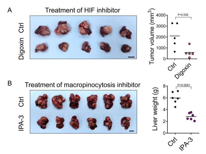 Discovering a new metabolic route for liver cancer and paving the way for new therapeutic opportunities