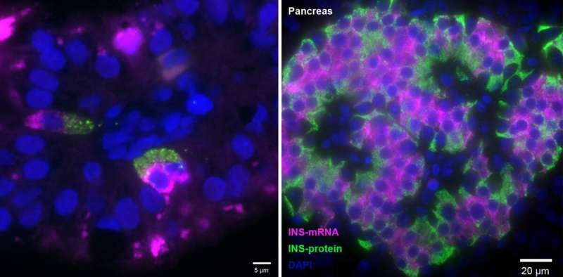 While waiting for food: The surprising fetal gut cells that make insulin