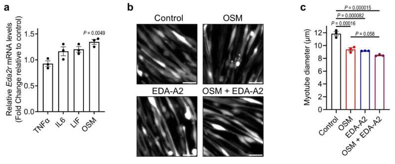 An elusive mechanism of wasting syndrome cachexia revealed