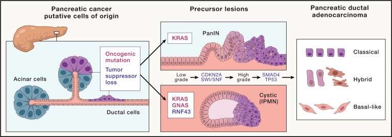 Hallmarks to improving pancreatic cancer therapy identified by UC Irvine researchers