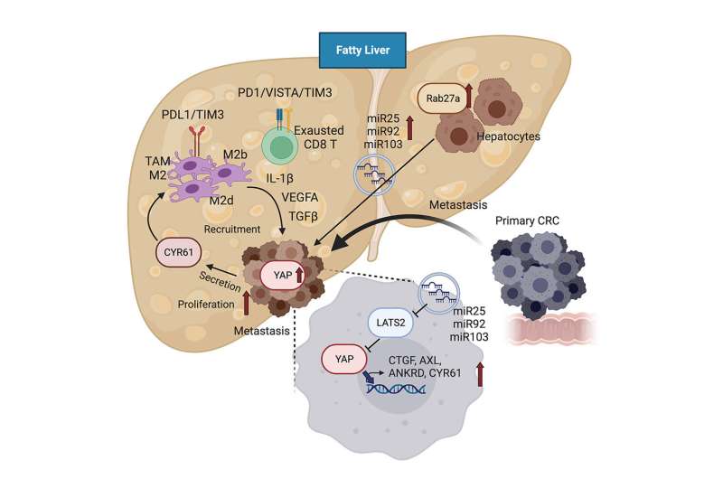 Study Reveals How Fatty Liver Promotes Colorectal Cancer Spread