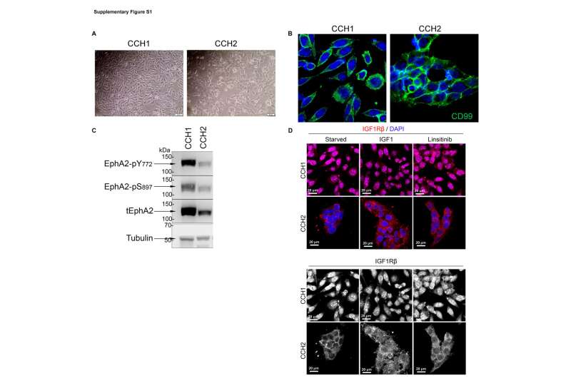 Ewing sarcoma tumors can be split into two groups for targeted care