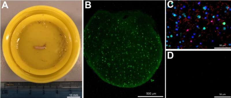 New approach to traumatic brain injuries could revolutionise diagnosis and treatment