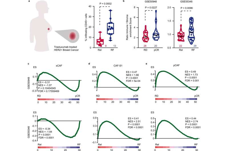 Researchers overcome treatment resistance mechanism in one of the most aggressive types of breast cancer