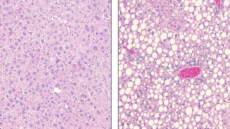 New discoveries about enzyme’s metabolic role may lead to better diabetes treatments