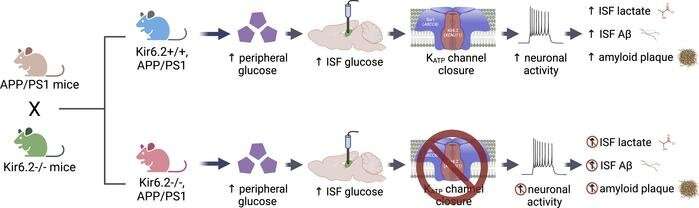 Scientists discover that metabolic sensor may play role in Alzheimer's disease