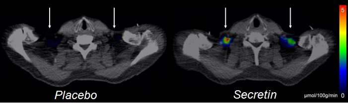 Secretin hormone induces satiation by activating brown fat