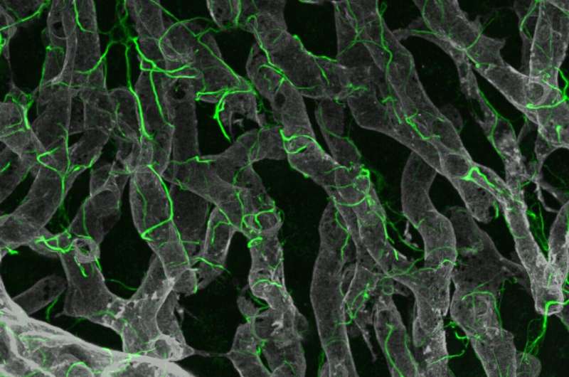 Potential new targets identified in advanced non-alcoholic fatty liver disease