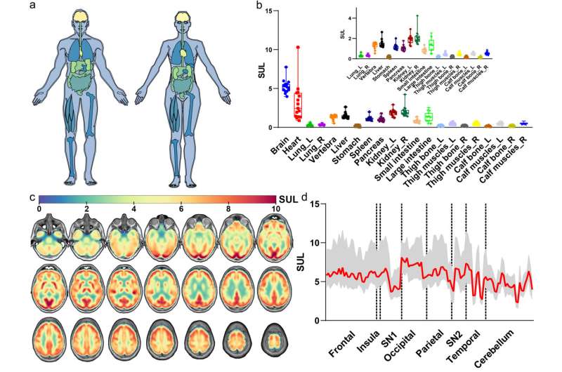 Study provides an atlas of detailed glucose uptake profiles across the human body