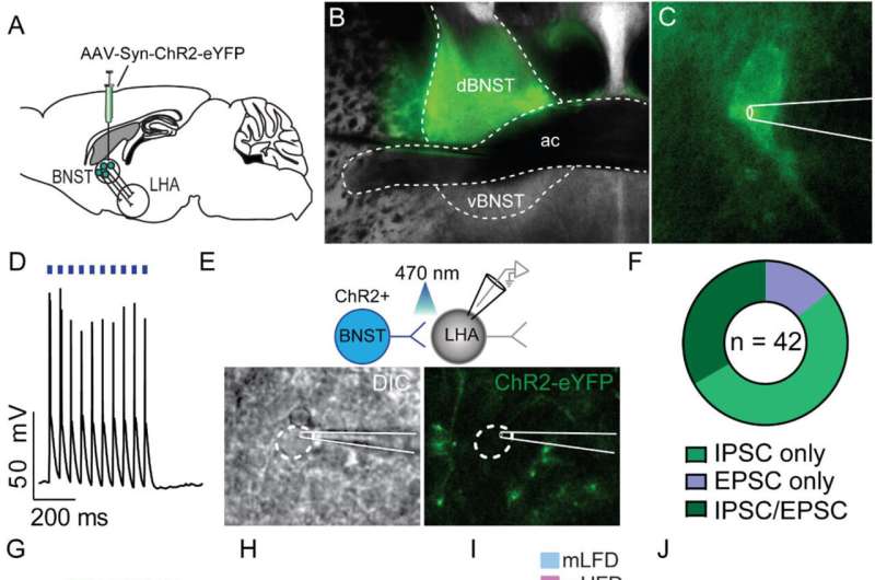 Excess calories during development alter the brain and spur adult overeating