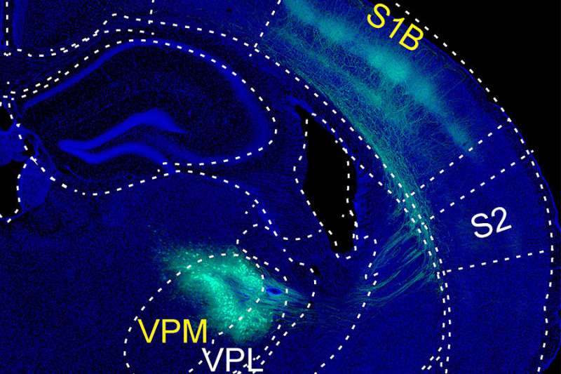 How touch dampens brain's response to painful stimuli