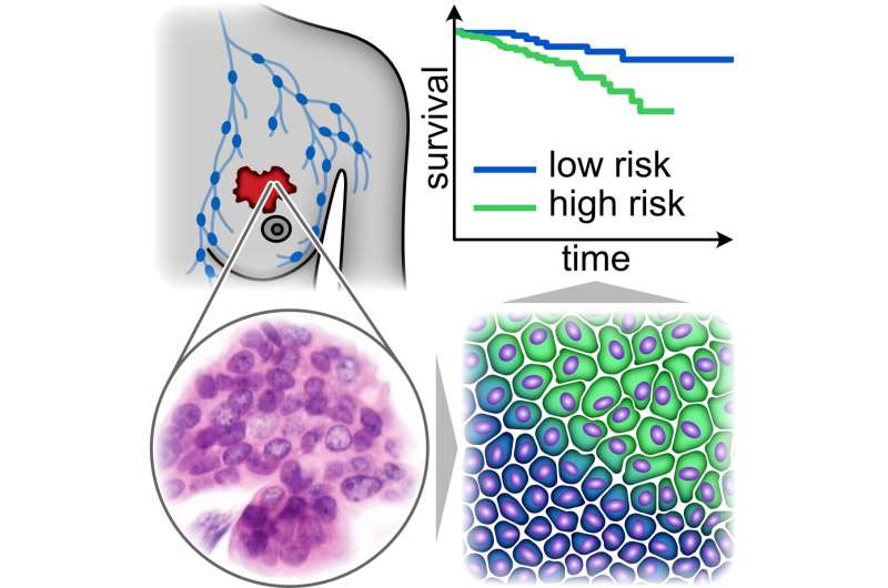 Researchers develop new marker for cancer cell motility