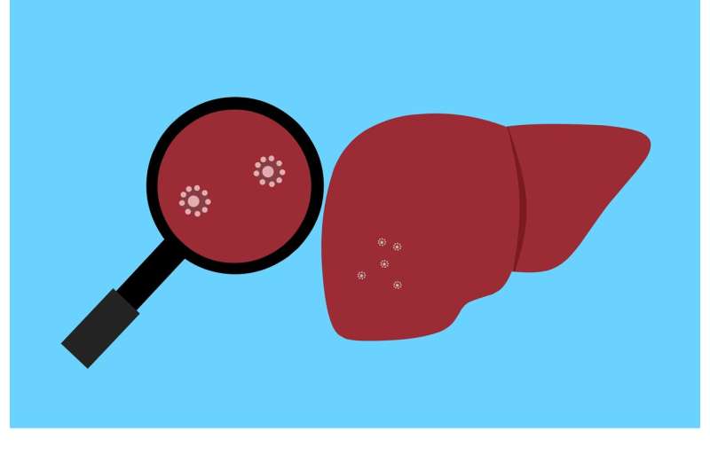 Study finds hydroxychloroquine lowers risk of nonalcoholic fatty liver disease in rheumatoid arthritis patients