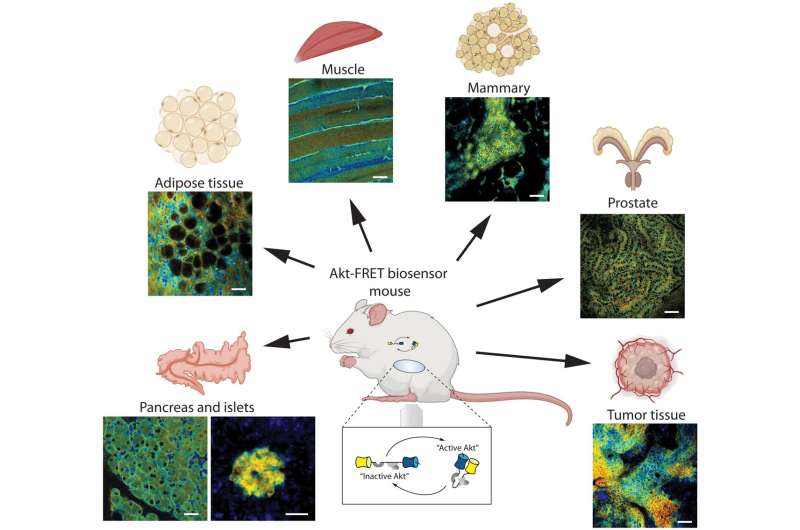 Researchers image live drug response and resistant 'pockets' in pancreatic cancer