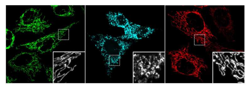 Active ingredient in cannabis protects aging brain cells