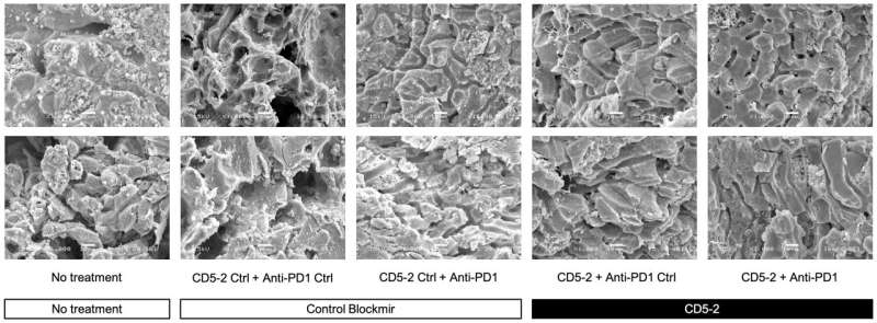 New treatment trialed in mice offers hope for advanced liver cancer