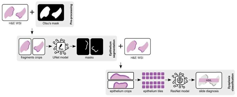 Using high-res images to detect precancerous cervical lesions