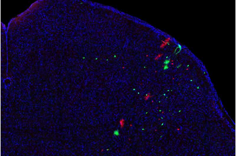 The pedigree of brain cells