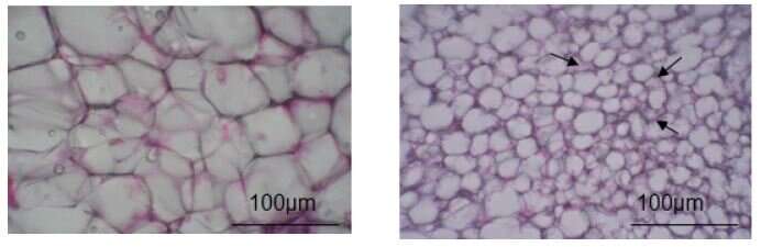 Flavor your food with “flavanols (flavan 3-ols)” to burn excess fat, new study suggests