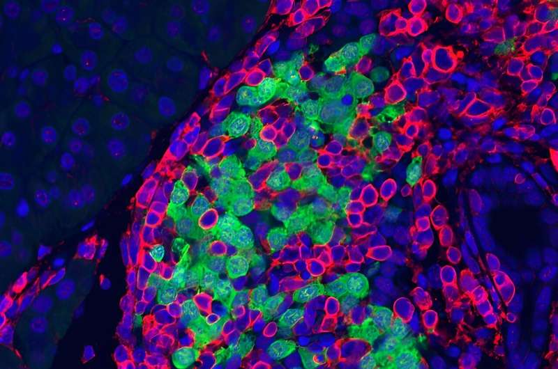 A novel angle on type 1 diabetes: RNA editing disruption mimics early-stage disease with no involvement of virus