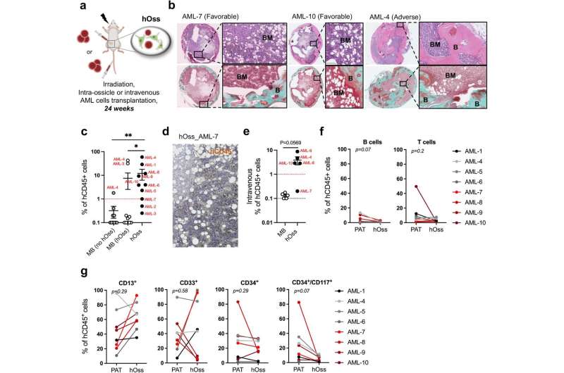 Toward a personalized approach to the study and treatment of bone cancers