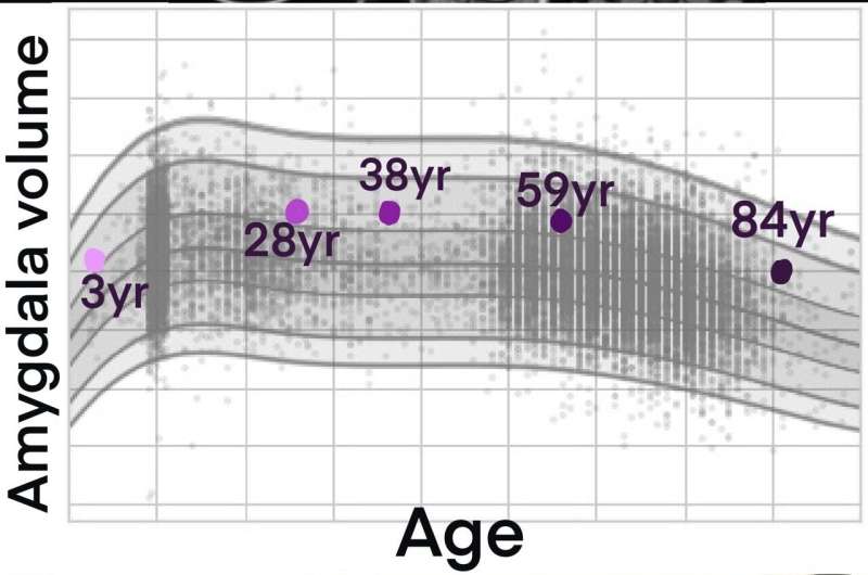 Growth charts for the brain help to understand mental illness