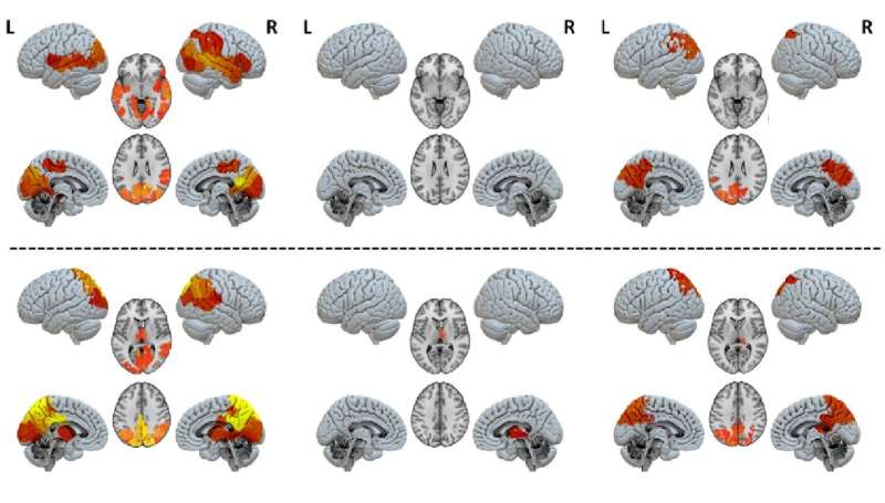 Brain modelling used to identify necessary circuits of consciousness