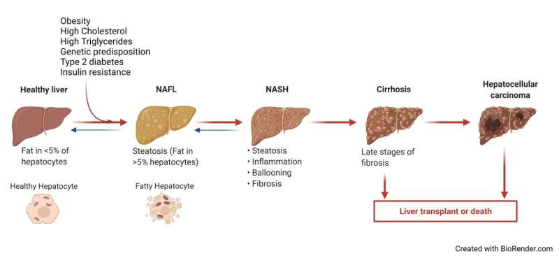 New review elucidates potential contributors to non-alcoholic fatty liver disease