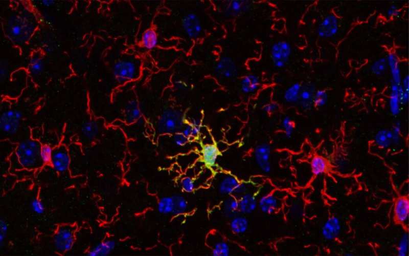 Immune cells of the brain are not all the same – new research could open novel therapeutic pathways